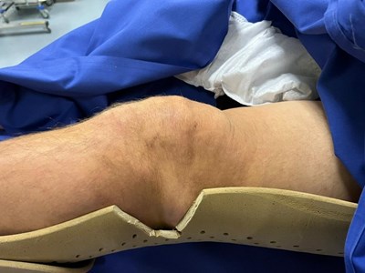 Knie des Patienten