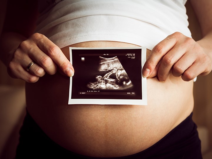 Frau hält Ultraschallbild vor Schwangerschaftsbauch