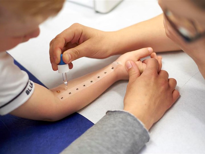 Durchführung eines Allergietests an der Hand von Kind